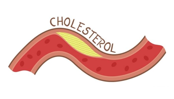 dau-ca-giup-can-bang-triglyceride-va-cholesterol